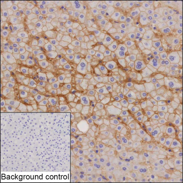 Anti-CA14