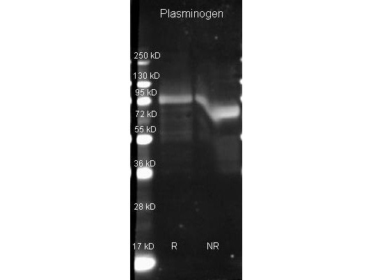 Anti-Plasminogen (human plasma)