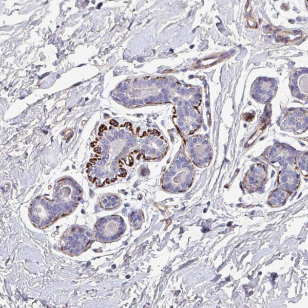 Anti-ATP2C2