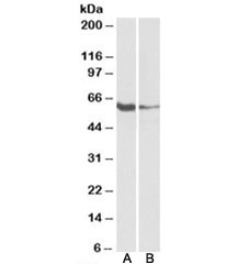 Anti-FCRL2