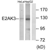 Anti-EIF2AK3