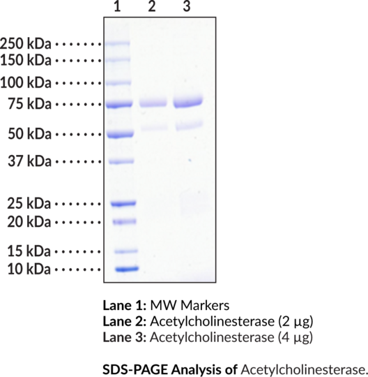 Acetylcholinesterase (eel)