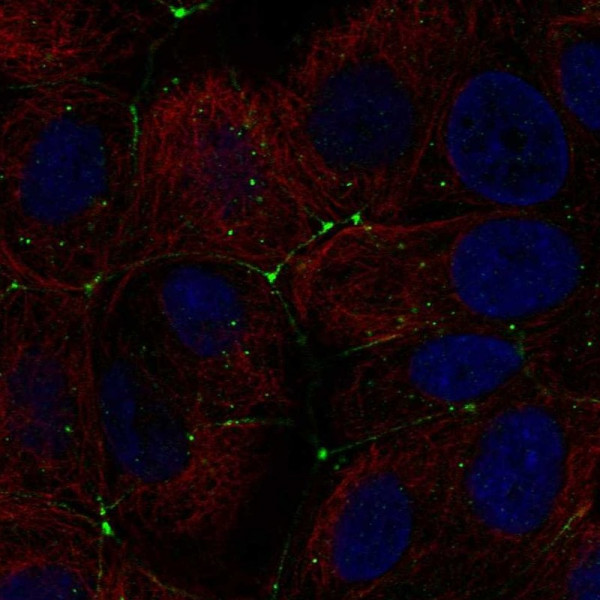 Anti-CLDN9