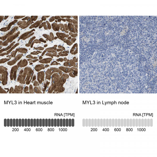 Anti-MYL3