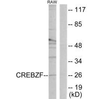 Anti-CREBZF