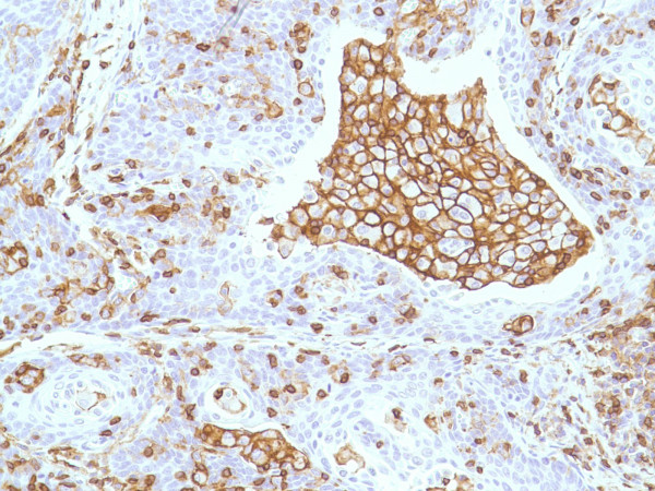 Anti-CD45/T200/LCA, clone SPM496