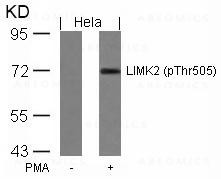 Anti-phospho-LIMK2 (Thr505)