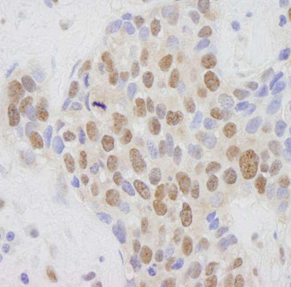 Anti-CRSP1/TRAP220 (IHC)