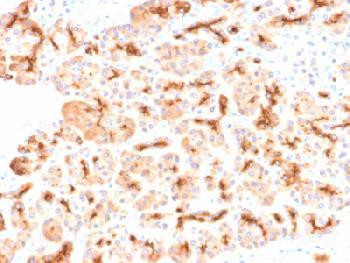 Anti-CFTR (Cystic Fibrosis Transmembrane Conductance Regulator) Recombinant Rabbit Monoclonal Antibo