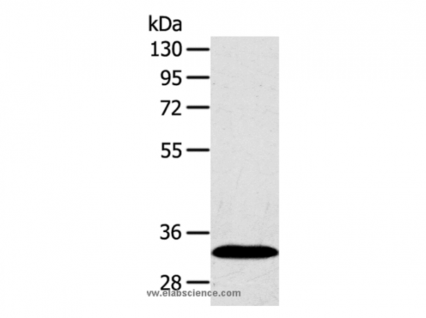 Anti-SULT2A1