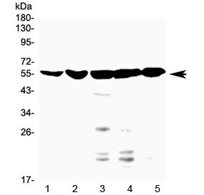 Anti-FXR / Farnesoid X Receptor / Bile Acid Receptor NR1H4 (C-Terminal Region)
