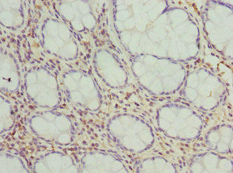 Anti-FMO1