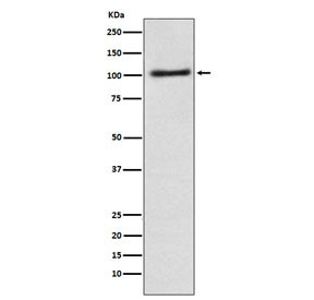 Anti-AP2A1 / Alpha 1 adaptin, clone AFDO-1