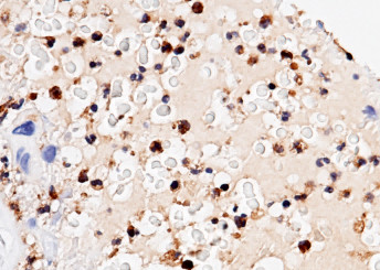 Anti-Ficolin-1/Ficolin-A/FCN1 Monoclonal Recombinant Antibody