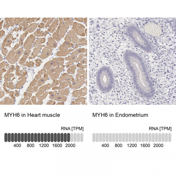 Anti-MYH6