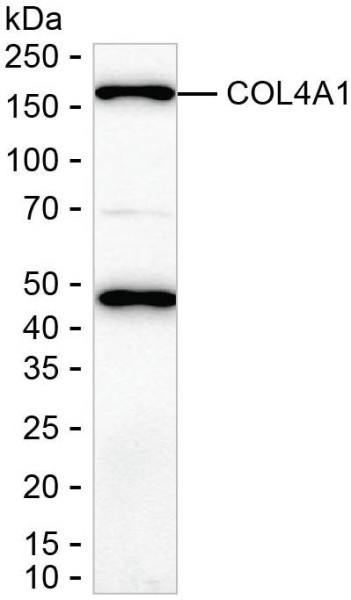 Anti-COL4A1