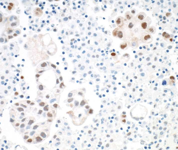 Anti-STAT3 Recombinant Monoclonal
