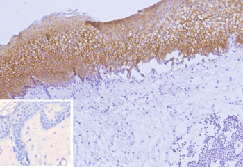 Anti-NECTIN4 / Nectin cell adhesion molecule 4, clone NECTIN4/9906