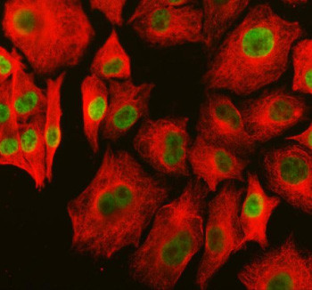Anti-PARP15 / Poly ADP-ribose polymerase 15
