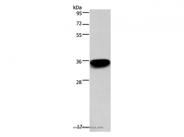 Anti-PRPS1/2/1L1