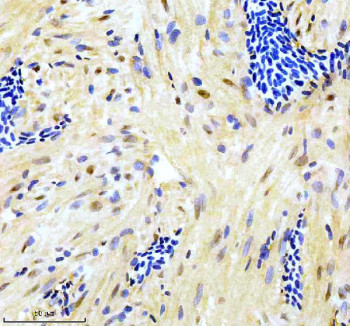Anti-Zebrafish Gata6 / GATA-binding factor 6