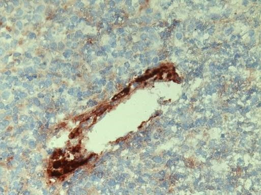 Anti-C1q, Mouse, mAb 7H8