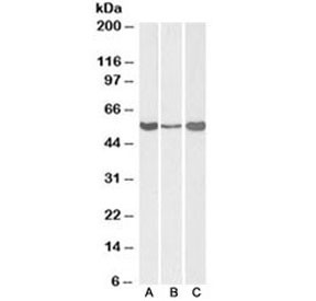 Anti-ALDH1A1