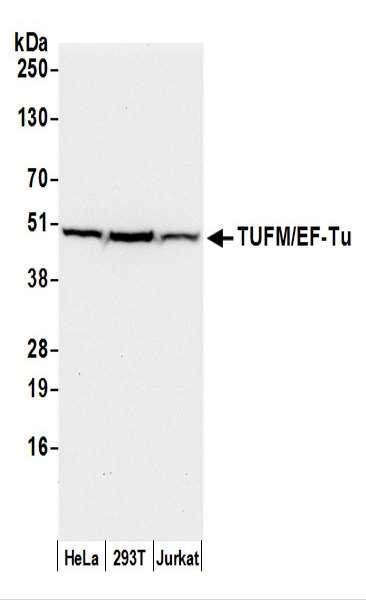 Anti-TUFM/EF-Tu