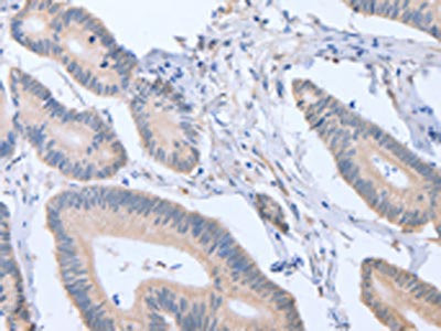 Anti-ACVR1C