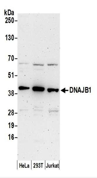Anti-DNAJB1/Hsp40