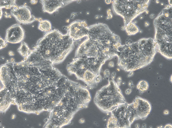 HROC39 Cells