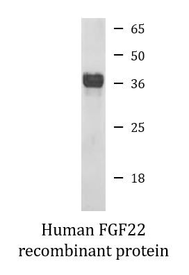 Human FGF22 recombinant protein (Active)