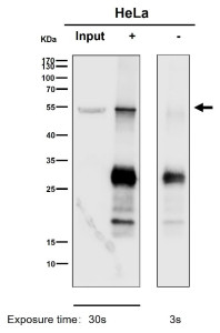 Anti-PPP2R5E / Serine threonine protein phosphatase 2A regulatory subunit B epsilon, clone 30P58