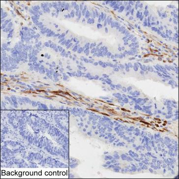 Anti-TGM2