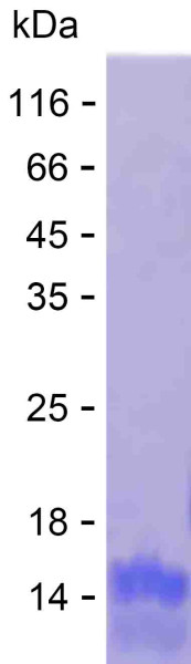 Recombinant Human ZNF841 Protein