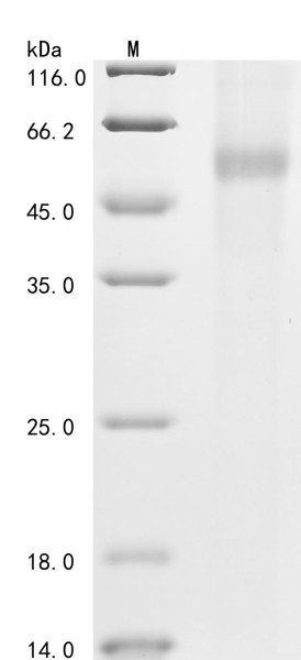 Muscle, skeletal receptor tyrosine-protein kinase (MUSK),partial, human, recombinant