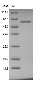 Alanine aminotransferase 1 (Gpt), mouse, recombinant