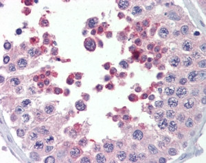 Anti-MLL4, C-terminal