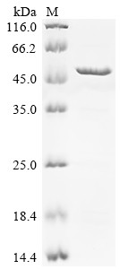 Melanoma-associated antigen 8 (MAGEA8), human, recombinant