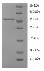 Serine--pyruvate aminotransferase (AGXT), human, recombinant