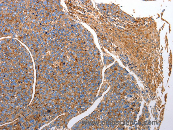 Anti-CD151
