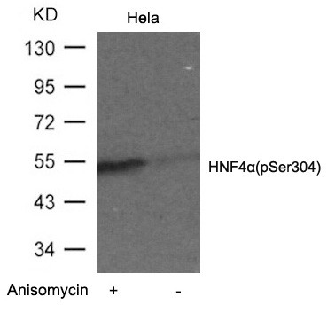 Anti-phospho-HNF4 alpha (Ser304)