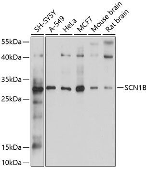 Anti-SCN1B