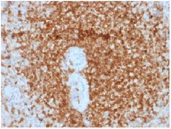 Anti-Bcl-2 (Apoptosis and Follicular Lymphoma Marker) Recombinant Mouse Monoclonal Antibody (clone:r