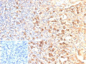 Anti-CD25 / IL2RA, clone rIL2RA/12624