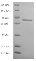 Dynamin-1 (DNM1), partial, human, recombinant