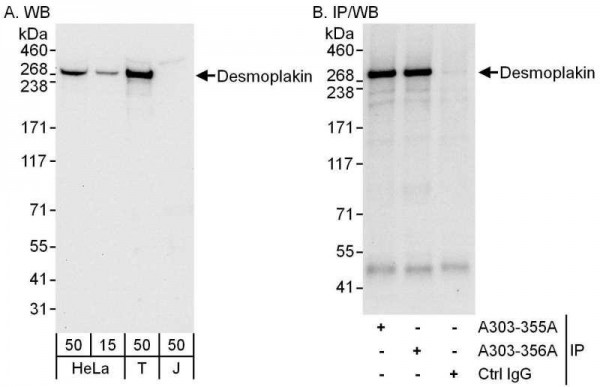 Anti-Desmoplakin