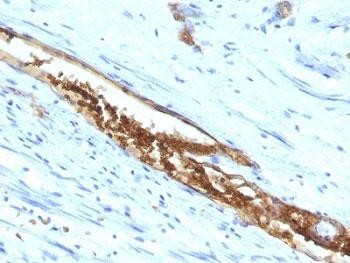 Anti-ABO (Blood Group Antigen A), clone 3-3A