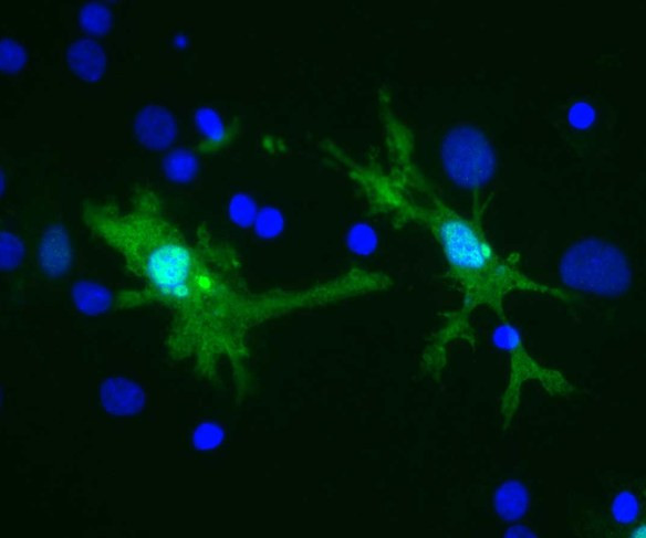Anti-Galectin 3, clone 5C21
