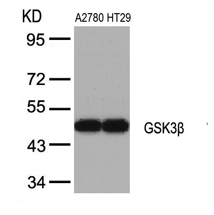 Anti-GSK3 beta